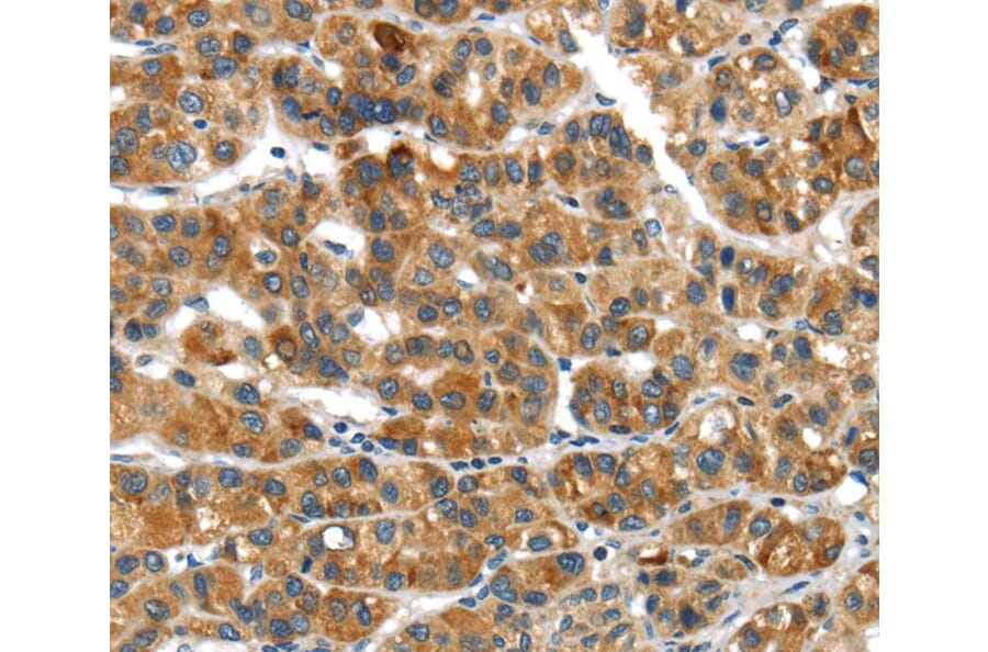 Immunohistochemistry - UBAP2 Antibody from Signalway Antibody (40276) - Antibodies.com
