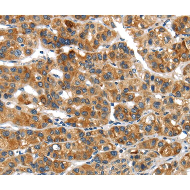 Immunohistochemistry - UBAP2 Antibody from Signalway Antibody (40276) - Antibodies.com