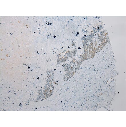 Immunohistochemistry - HAUS7 Antibody from Signalway Antibody (40279) - Antibodies.com