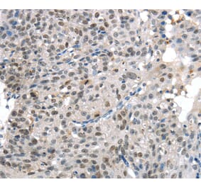 Immunohistochemistry - KDM5C Antibody from Signalway Antibody (40282) - Antibodies.com