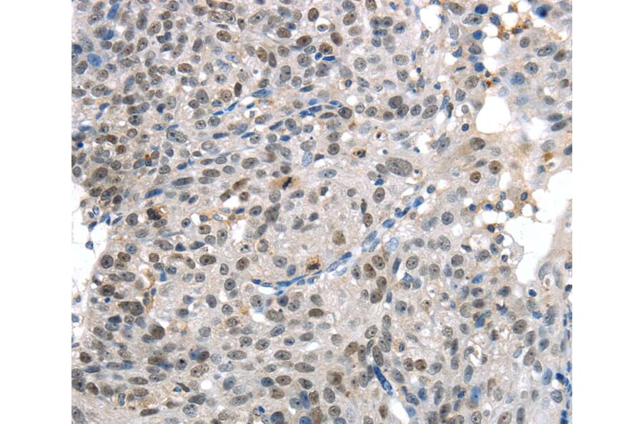 Immunohistochemistry - KDM5C Antibody from Signalway Antibody (40282) - Antibodies.com