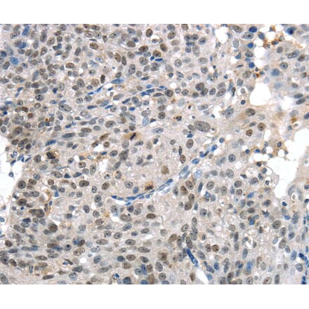 Immunohistochemistry - KDM5C Antibody from Signalway Antibody (40282) - Antibodies.com