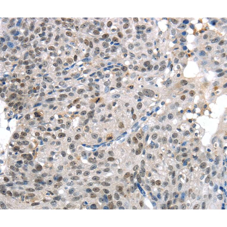 Immunohistochemistry - KDM5C Antibody from Signalway Antibody (40282) - Antibodies.com
