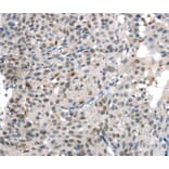 Immunohistochemistry - KDM5C Antibody from Signalway Antibody (40282) - Antibodies.com