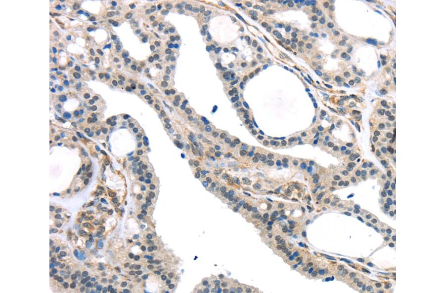 Immunohistochemistry - KDM5C Antibody from Signalway Antibody (40282) - Antibodies.com