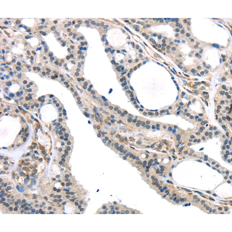 Immunohistochemistry - KDM5C Antibody from Signalway Antibody (40282) - Antibodies.com