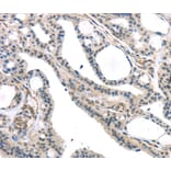 Immunohistochemistry - KDM5C Antibody from Signalway Antibody (40282) - Antibodies.com