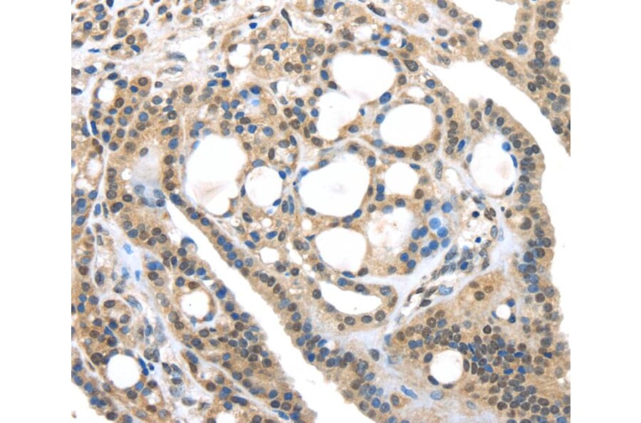 Immunohistochemistry - USP9X Antibody from Signalway Antibody (40285) - Antibodies.com