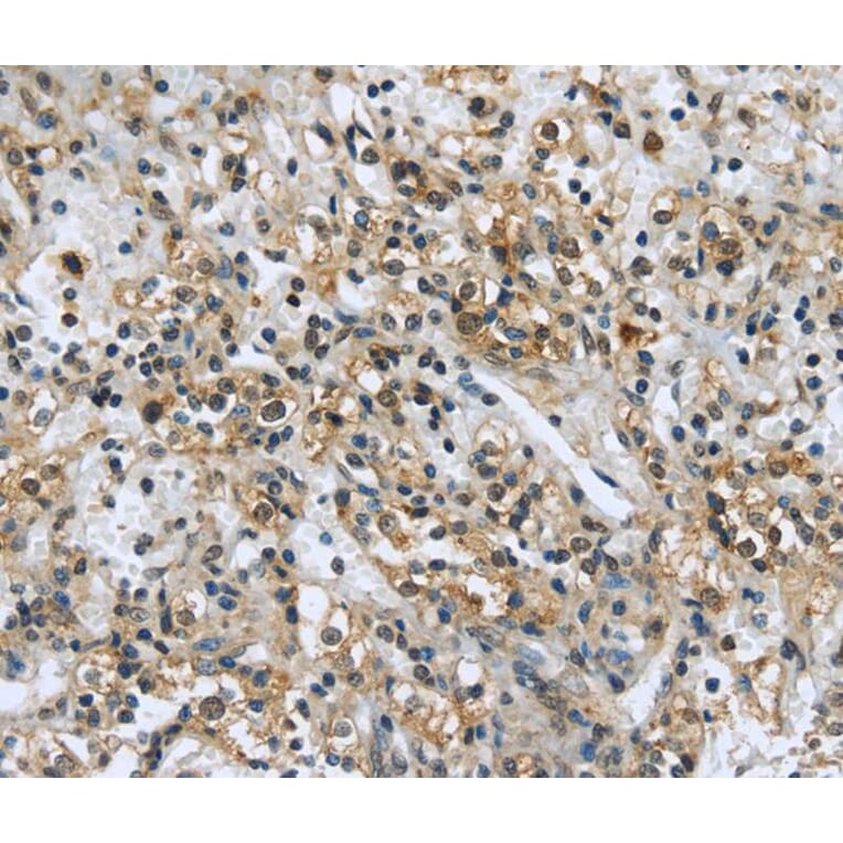 Immunohistochemistry - USP28 Antibody from Signalway Antibody (40286) - Antibodies.com