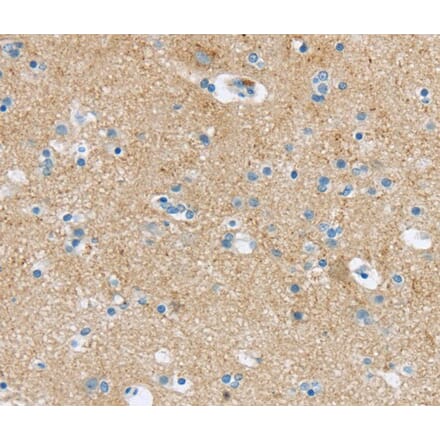 Immunohistochemistry - VAMP1 Antibody from Signalway Antibody (40289) - Antibodies.com