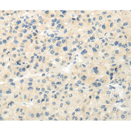 Immunohistochemistry - VIPR1 Antibody from Signalway Antibody (40290) - Antibodies.com