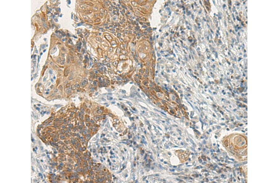 Immunohistochemistry - VIPR2 Antibody from Signalway Antibody (40291) - Antibodies.com