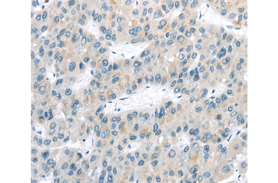 Immunohistochemistry - VLDLR Antibody from Signalway Antibody (40292) - Antibodies.com