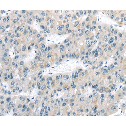 Immunohistochemistry - VLDLR Antibody from Signalway Antibody (40292) - Antibodies.com