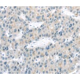 Immunohistochemistry - VLDLR Antibody from Signalway Antibody (40292) - Antibodies.com