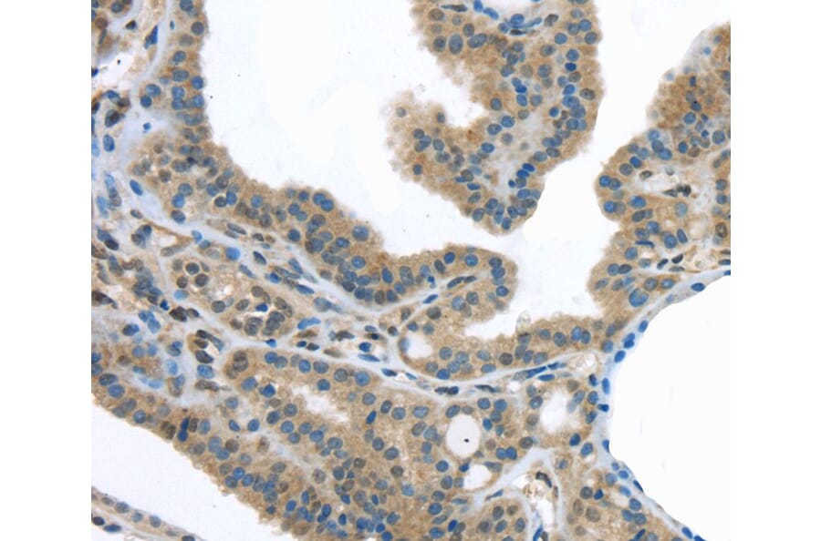 Immunohistochemistry - VLDLR Antibody from Signalway Antibody (40292) - Antibodies.com