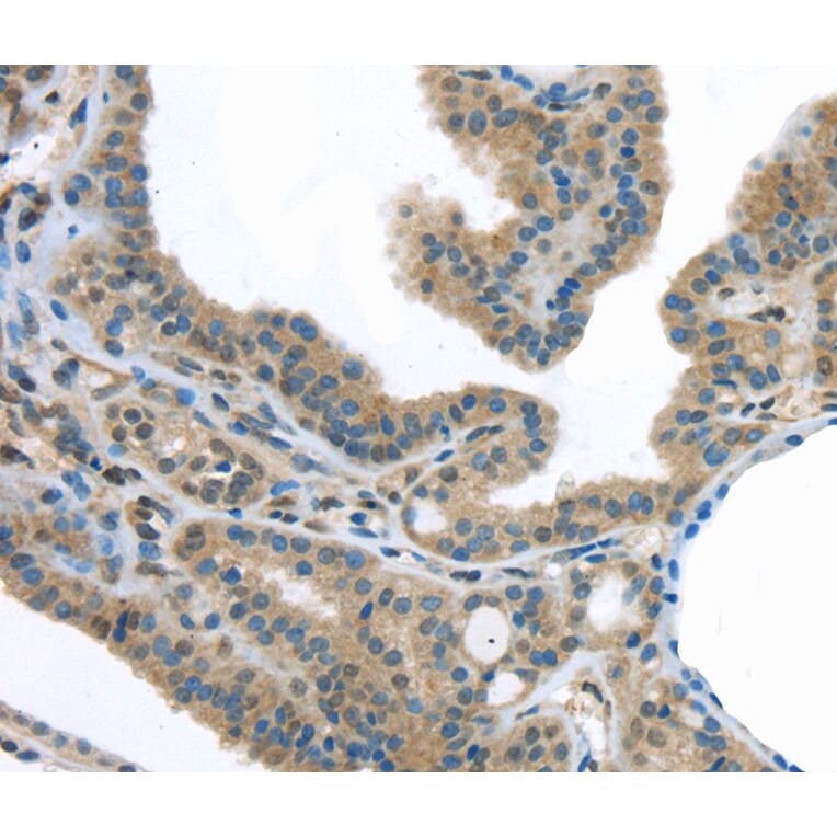 Immunohistochemistry - VLDLR Antibody from Signalway Antibody (40292) - Antibodies.com