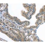 Immunohistochemistry - VLDLR Antibody from Signalway Antibody (40292) - Antibodies.com