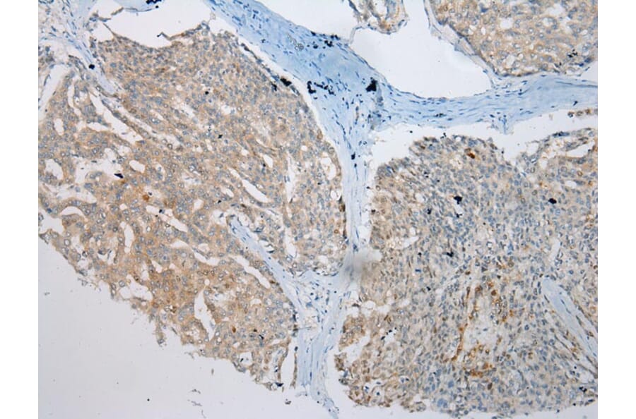 Immunohistochemistry - VPS4A Antibody from Signalway Antibody (40294) - Antibodies.com
