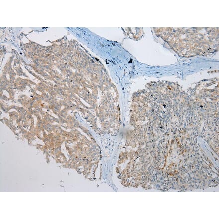 Immunohistochemistry - VPS4A Antibody from Signalway Antibody (40294) - Antibodies.com