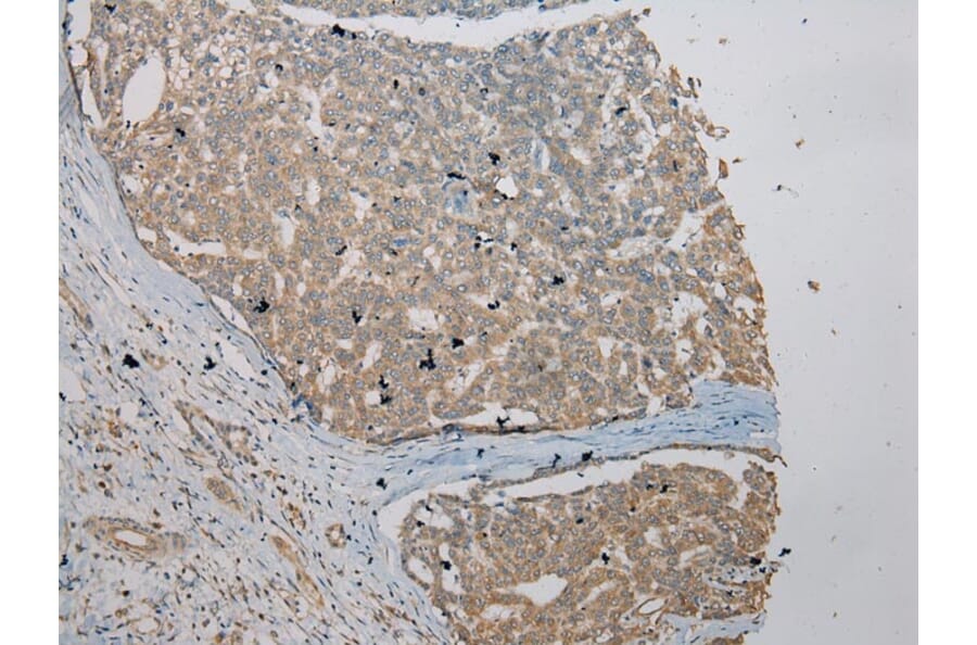 Immunohistochemistry - VPS36 Antibody from Signalway Antibody (40296) - Antibodies.com