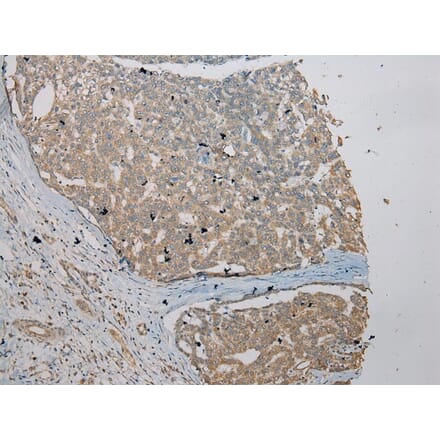 Immunohistochemistry - VPS36 Antibody from Signalway Antibody (40296) - Antibodies.com