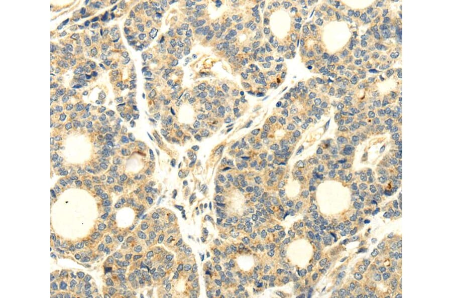 Immunohistochemistry - WDR91 Antibody from Signalway Antibody (40297) - Antibodies.com