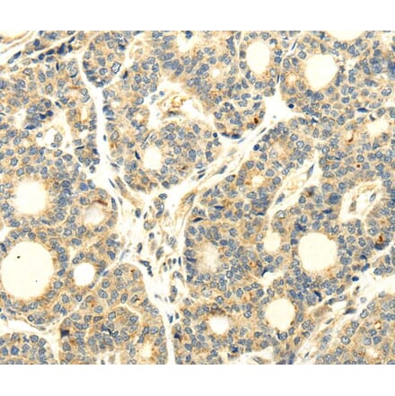 Immunohistochemistry - WDR91 Antibody from Signalway Antibody (40297) - Antibodies.com
