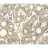 Immunohistochemistry - WDR91 Antibody from Signalway Antibody (40297) - Antibodies.com