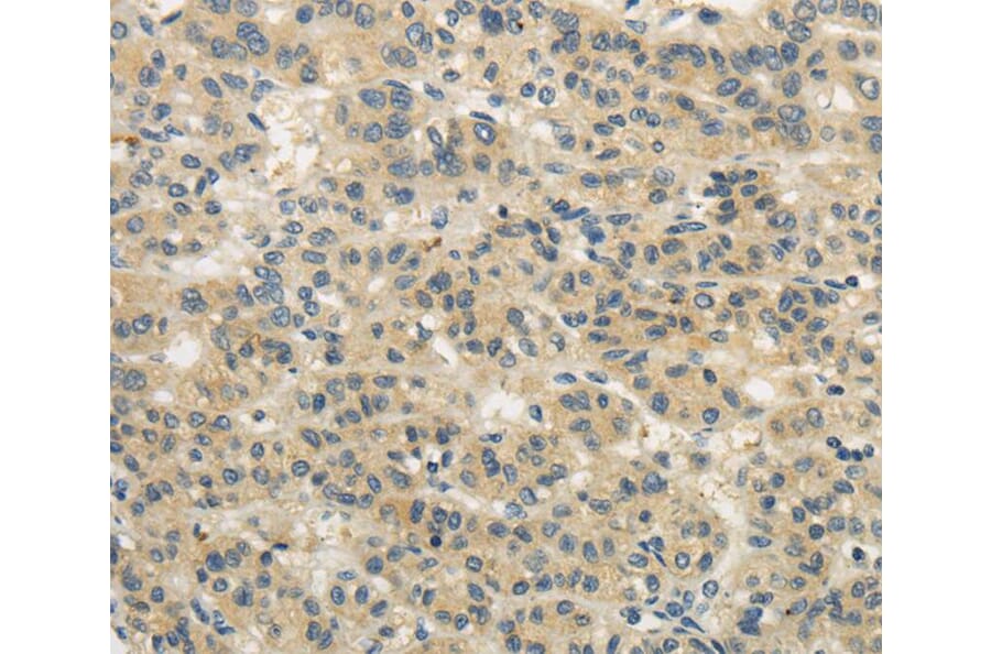 Immunohistochemistry - WDR91 Antibody from Signalway Antibody (40297) - Antibodies.com