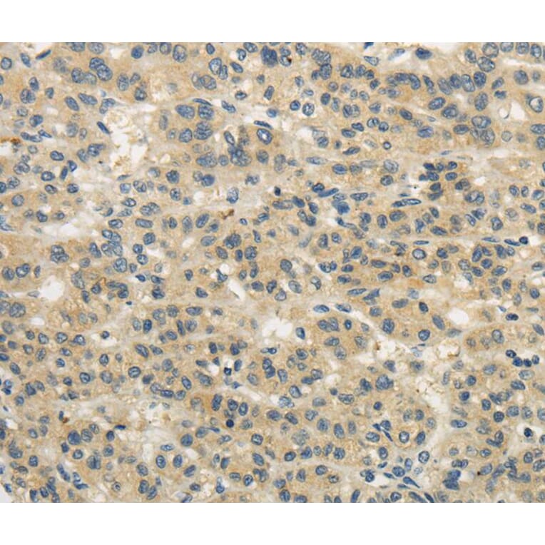 Immunohistochemistry - WDR91 Antibody from Signalway Antibody (40297) - Antibodies.com