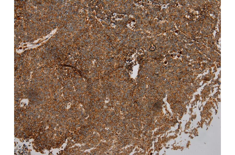 Immunohistochemistry - WFDC1 Antibody from Signalway Antibody (40300) - Antibodies.com