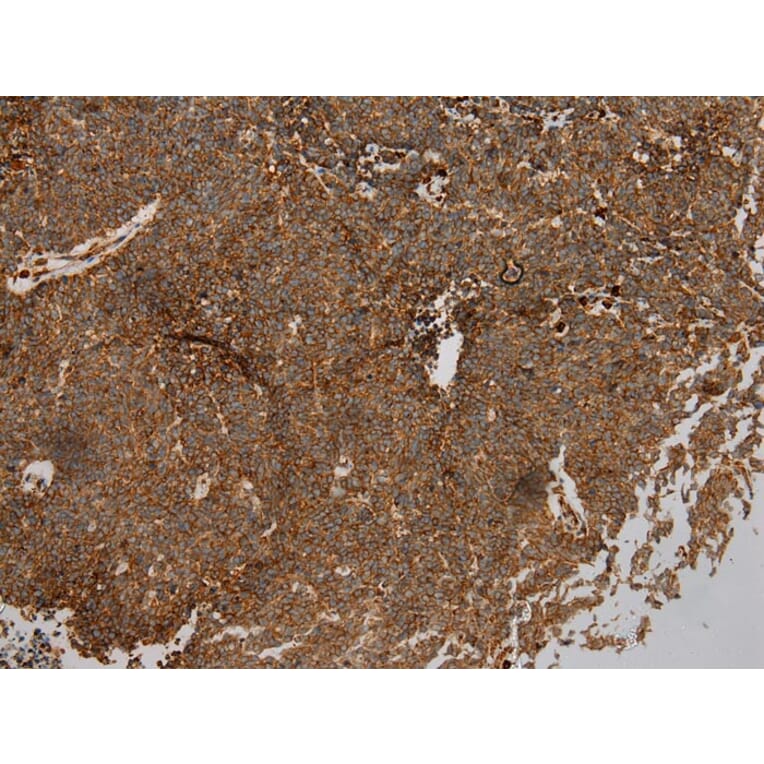 Immunohistochemistry - WFDC1 Antibody from Signalway Antibody (40300) - Antibodies.com