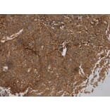 Immunohistochemistry - WFDC1 Antibody from Signalway Antibody (40300) - Antibodies.com
