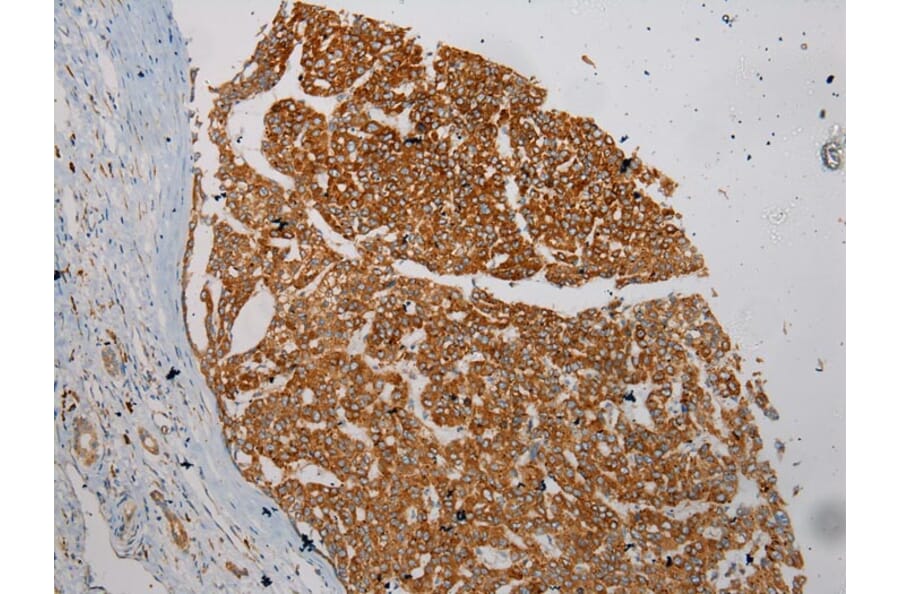 Immunohistochemistry - WFDC1 Antibody from Signalway Antibody (40300) - Antibodies.com
