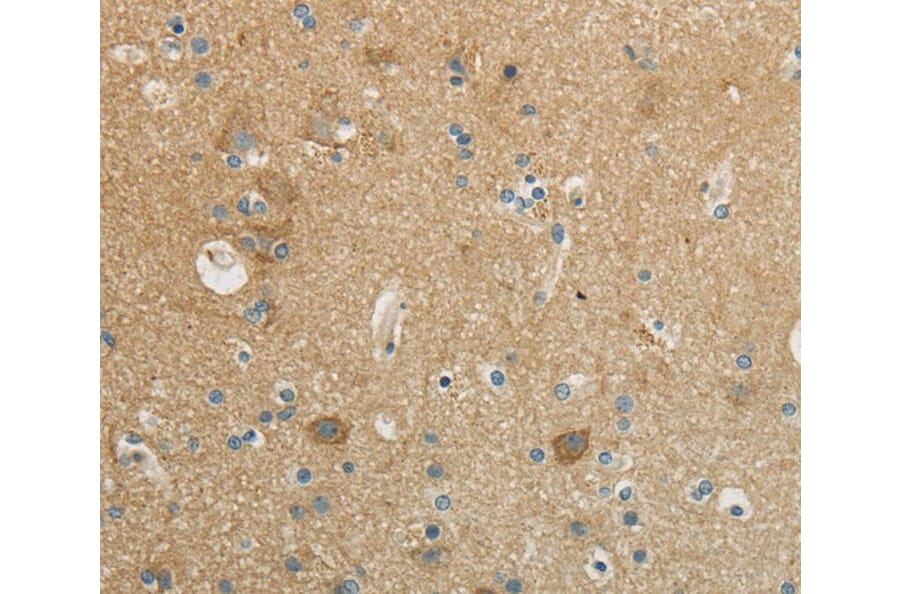 Immunohistochemistry - WISP1 Antibody from Signalway Antibody (40301) - Antibodies.com