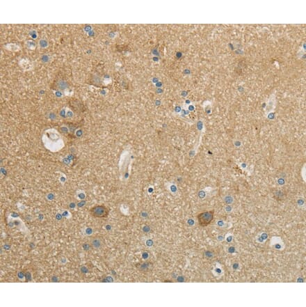 Immunohistochemistry - WISP1 Antibody from Signalway Antibody (40301) - Antibodies.com