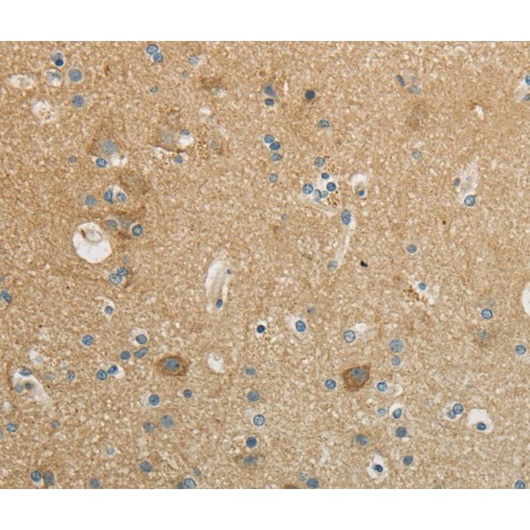 Immunohistochemistry - WISP1 Antibody from Signalway Antibody (40301) - Antibodies.com
