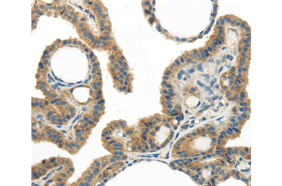 Immunohistochemistry - WISP1 Antibody from Signalway Antibody (40301) - Antibodies.com