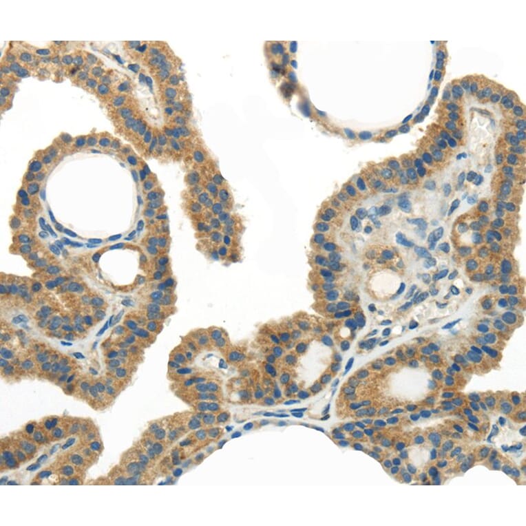 Immunohistochemistry - WISP1 Antibody from Signalway Antibody (40301) - Antibodies.com