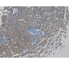 Immunohistochemistry - IL-20 Antibody from Signalway Antibody (40305) - Antibodies.com