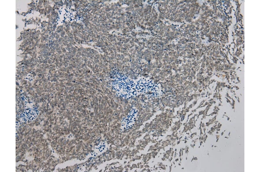 Immunohistochemistry - IL-20 Antibody from Signalway Antibody (40305) - Antibodies.com