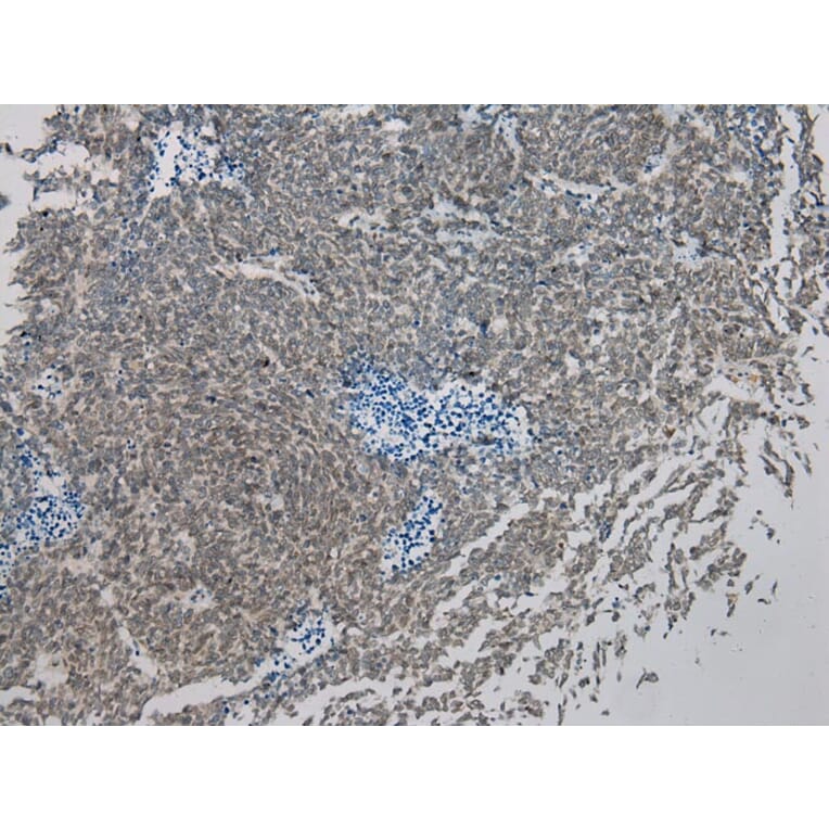 Immunohistochemistry - IL-20 Antibody from Signalway Antibody (40305) - Antibodies.com