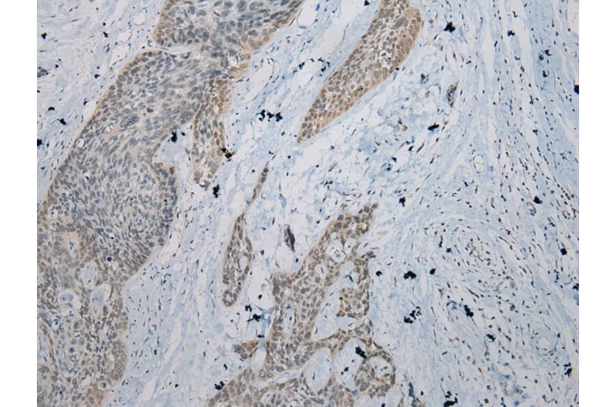 Immunohistochemistry - IL-20 Antibody from Signalway Antibody (40305) - Antibodies.com