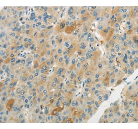 Immunohistochemistry - WNT2B Antibody from Signalway Antibody (40309) - Antibodies.com