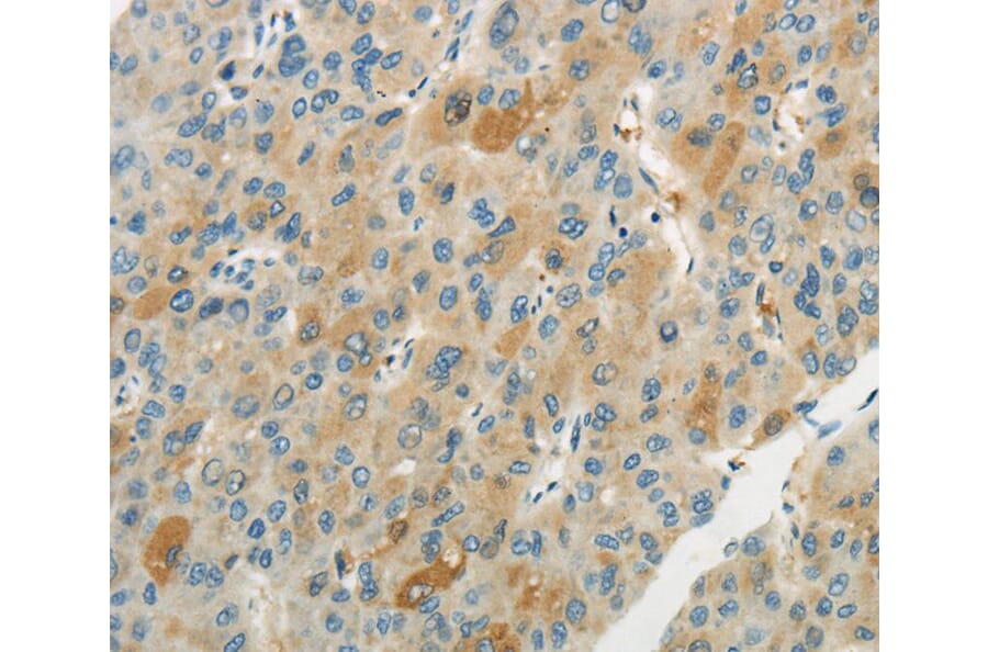 Immunohistochemistry - WNT2B Antibody from Signalway Antibody (40309) - Antibodies.com