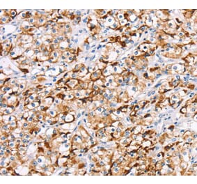 Immunohistochemistry - RDH11 Antibody from Signalway Antibody (40320) - Antibodies.com