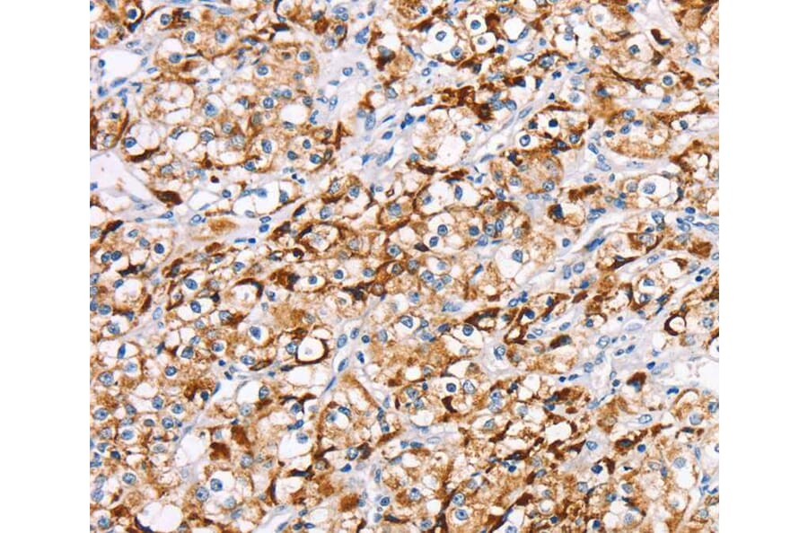 Immunohistochemistry - RDH11 Antibody from Signalway Antibody (40320) - Antibodies.com