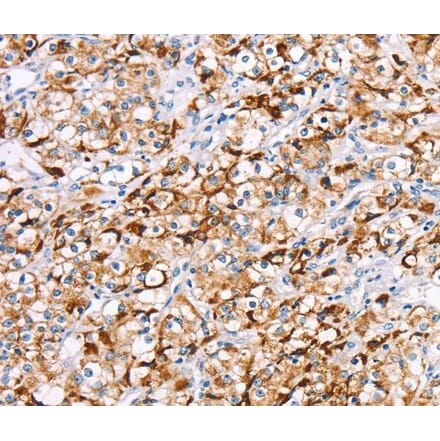 Immunohistochemistry - RDH11 Antibody from Signalway Antibody (40320) - Antibodies.com