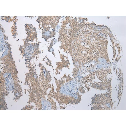 Immunohistochemistry - SSBP4 Antibody from Signalway Antibody (40337) - Antibodies.com